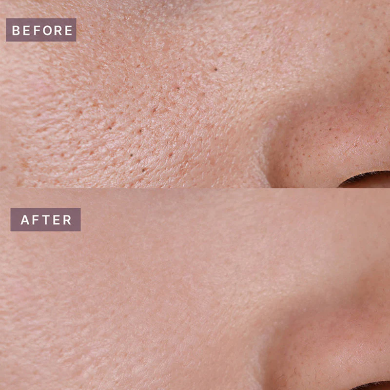 Pot Pore Tightening Podo Ampoule - Image 7